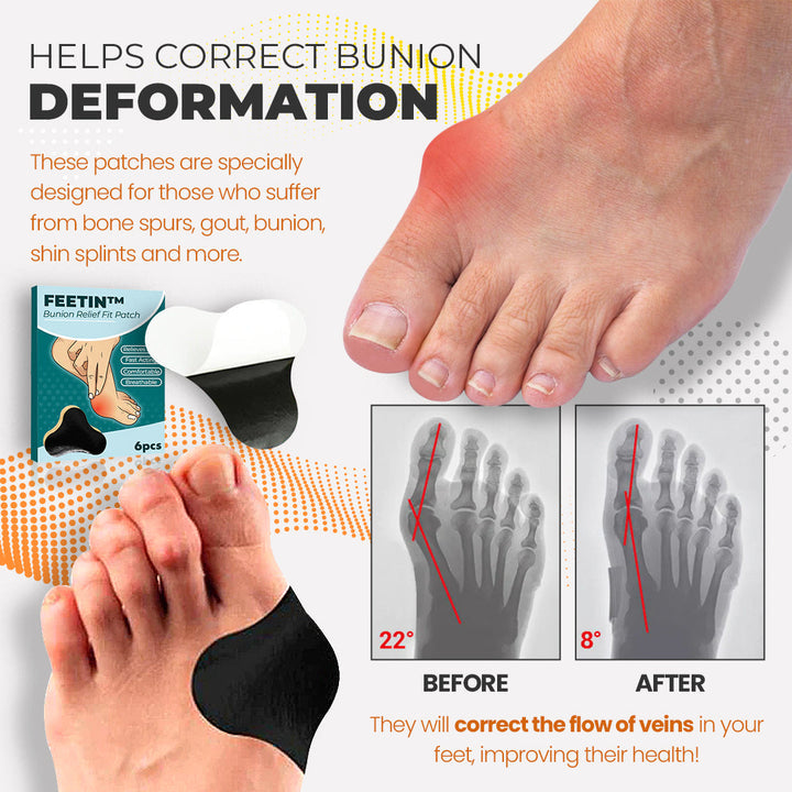 Feetin™ Bunion Relief Fit Patch