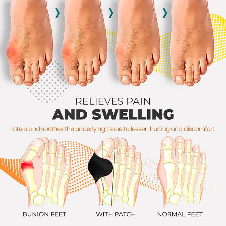 Feetin™ Bunion Relief Fit Patch