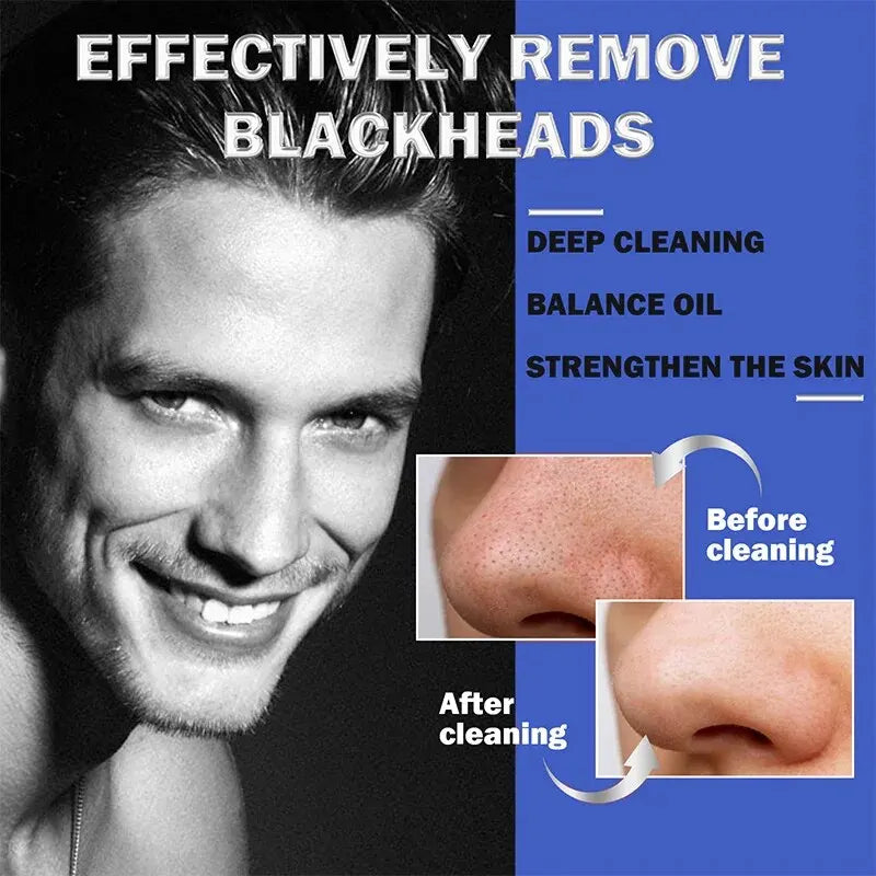 Blackhead stickers for men