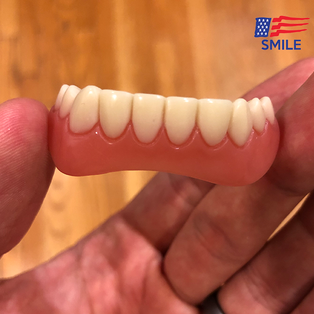 Last Day 49% OFF💕Adjustable Snap-On Dentures