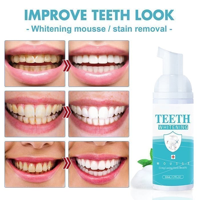 Latest👨‍⚕TEETH WHITENING MOUSSE🦷✨