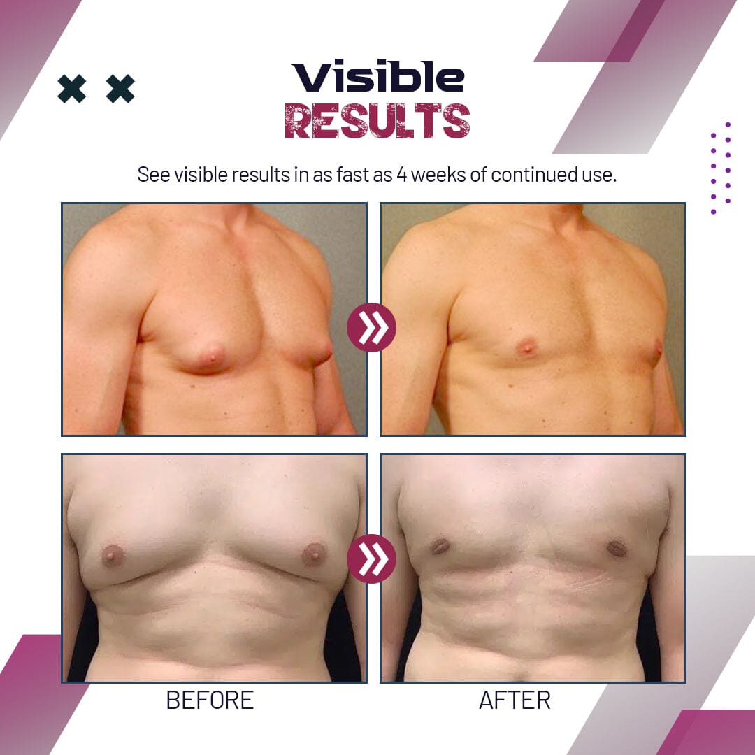 ChestX Gynecomastia Reduction Spray